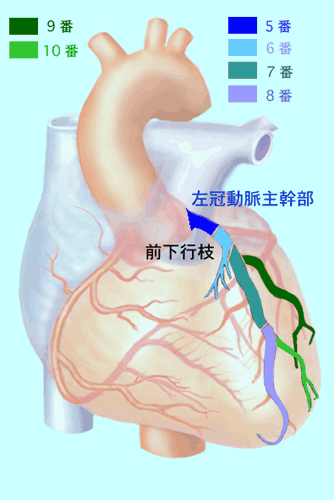 http://www.m-junkanki.com/case_study/lecture7/CAG-AHAclassLAD.gif