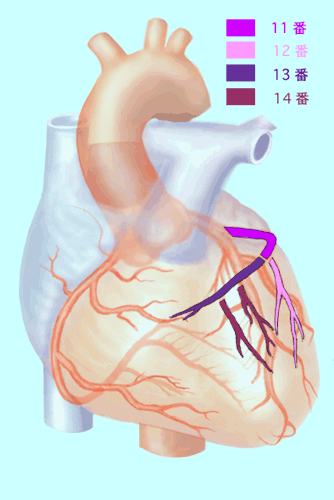 http://www.m-junkanki.com/case_study/lecture7/CAG-AHAclassLCX.gif