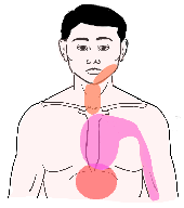 放散 心筋 痛 梗塞